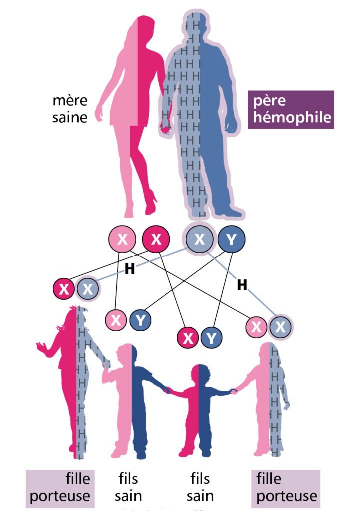 Association Béninoise des Hémophiles | ABH | Traitement Pour Tous ! - Qu’est-ce que l’hémophilie ?