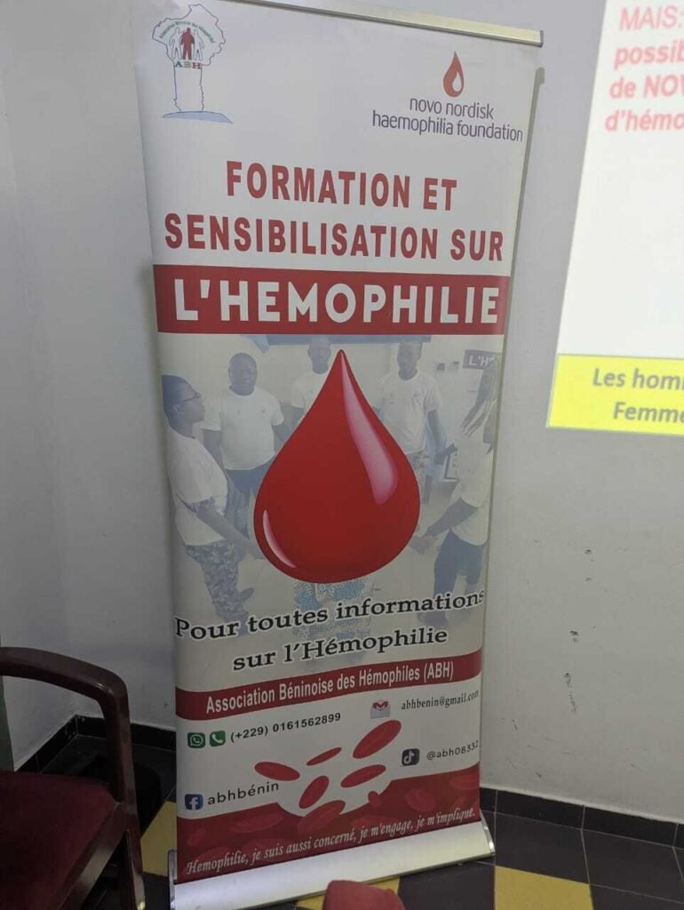 Association Béninoise des Hémophiles | ABH | Traitement Pour Tous ! - Formation sur l’établissement et l’interprétation de l’arbre généalogique dans le suivi et le conseil génétique de l’hémophilie Association Béninoise des Hémophiles | ABH | Traitement Pour Tous ! - Formation sur l’établissement et l’interprétation de l’arbre généalogique dans le suivi et le conseil génétique de l’hémophilie
